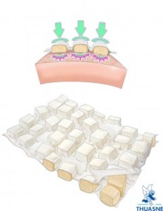 Mobiderm and how it works